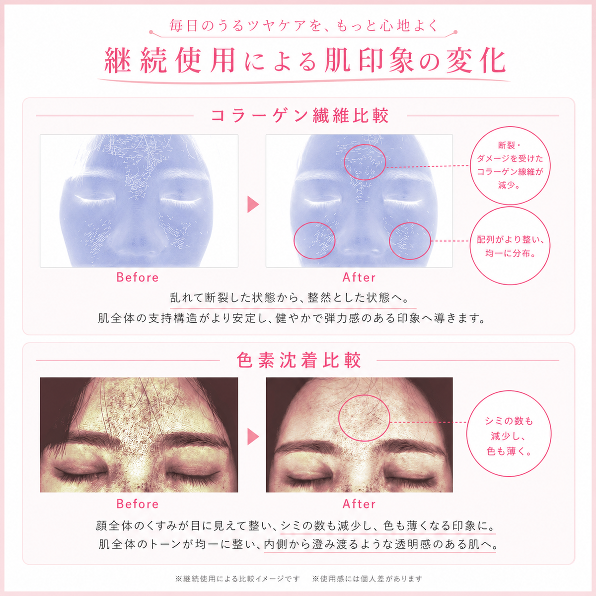 ANLAN Rose Lumi LED美顏儀 粉光全方位護膚